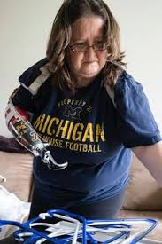 Limblessgirllacy hooks / i was electrocuted and lost three. 180 Hook Ideas In 2021 Amputee Amputee Model Prosthetic Leg
