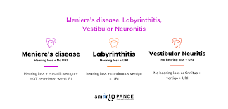 Image result for Bacterial Labyrinthitis