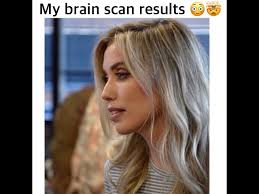 The Results Of My Brain Scan