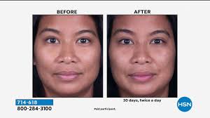 Check spelling or type a new query. Dermawand Pro Antiaging Kit With Preface And Skin Quench Youtube