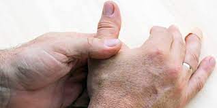 Schmerzen Zwischen Daumen Und Zeigefinger