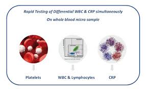 Reference ranges for fbc parameters obtained from phase ii of the pathology harmonisation project (pathologyharmony.co.uk). Horiba