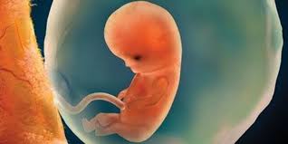 Placentas consisting of three or more lobes are extremely rare. The Prescient Placenta The Scientist Magazine