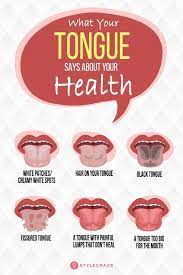 Pin On Teeth Health