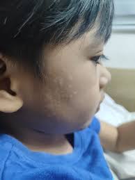 good eve po sana na po masagot hinihingal po ang anak ko umaalon ang tiyan  niya habang nahinga cya ok lng po ba yun, ano po pwwde ko gawen sana po may