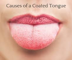 learn the causes of a coated tongue dr chauvin