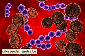  1  estes sintomas podem ser acompanhados de outros sintomas causados pela infeção subjacente específica, como mastite , osteomielite , fasceíte necrotizante. Choque Septico Que Es Sintomas Y Como Se Hace El Tratamiento Es Odysseedubienetre Be