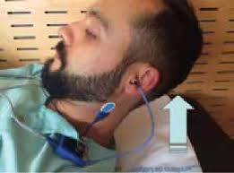 10. Para una contracción de ambos ECM y realizar un estímulo bilateral...