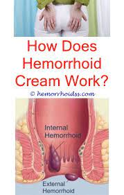 Pin On Hemorrhoid Relief