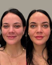 Rachel Codd DNP, AGACNP-BC (@rachelcodd.dnp) • Instagram photos and videos