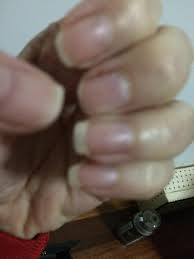 You can also take biotin supplements, which may help your nails grow faster and stronger. When You Nails Are Different Lengths Do You Cut Them All Short Or Wait Til They Grow A Bit Before You Trim Them So They Look Better Polished Redditlaqueristas