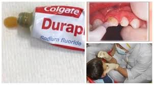 We did not find results for: Sapuan Florida Sejak Awal Akan Kuatkan Gigi Elak Karies 7 Perkara Ibu Ayah Patut Tahu