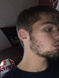 How they're related, we don't really know; Pin On Boys