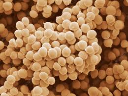 Image result for Staphylococcus Saprophyticus