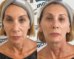 Ana Chamorro Estética...