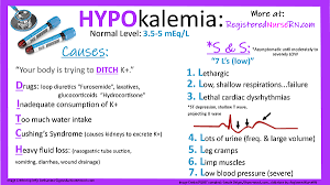 Hypokalemia Nclex Review Notes