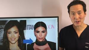Last updated on aug 21, 2020. Video Doctor Reveals What Plastic Surgery He Thinks Kim Kardashian Has Gotten Done With In Depth Analysis