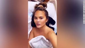 About to have my second blood transfusion which truly truly. Chrissy Teigen Loses Baby After Pregnancy Complications Calling It The Darkest Of Days Cnn