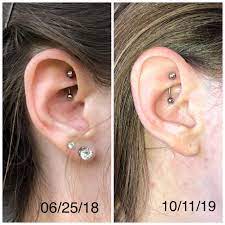 What Is Going On With My Rook Piercing Is Everything Fine I Got It Pierced 06 25 18 And I Had A Really Bad Infection That Took Place On July 2018 And Lasted Awhile