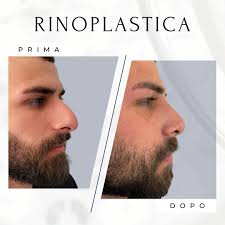 Dr. Antonio D'Ari, chirurgo plastico, medico estetico