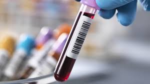 Image result for Blood Doping