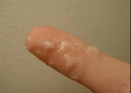 Jenis jenis awan, bentuk awan beserta ciri ciri awan, gambar awan, awan yang menimbulkan hujan awan stratus, cumulus, cumolonimbus, cara terbentuknya awan. 9 Jenis Keputihan Dan Artinya Bagi Kesehatan Anda Theasianparent Indonesia