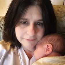 What kind of shirts and bras are recommended to wear after rotator cuff  surgery?