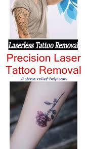 Tattoo Removal Surrey India Ink Tattoo Removal Does Laser Tattoo Removal Cause Blisters Tattoo Removal Tattoo Removal Cream Laser Tattoo Laser Tattoo Removal