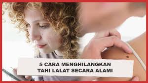 Cara nak buang tahi lalat adalah dengan pembedahan kecil yang memakai laser untuk meratakan permukaan kulit, lalu menutup luka itu supaya ia nampak normal seperti tidak pernah ada tahi lalat langsung. Ajaib Ini 5 Cara Menghilangkan Tahi Lalat Secara Alami Video Dailymotion