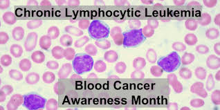 Disability awareness month is a national campaign that tries to raise awareness about disabled people who are employed. Blood Cancer Awareness Month Cll Medivizor