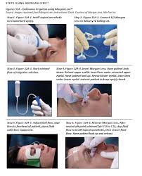 Image result for Eye Irrigation
