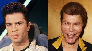 Interviewés par hapsatou sy, grischka a été catégorique : Grichka Bogdanoff Revele Ce Qui A Modifie Son Visage Femme Actuelle Le Mag