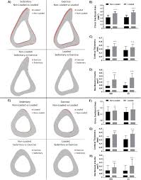 The real response of bone to exercise. Treadmill Running And Targeted Tibial Loading Differentially Improve Bone Mass In Mice Sciencedirect
