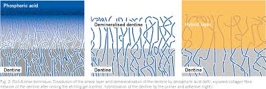 Ibond universal universal adhesive light cure 4 ml bottle value pack 3/pack category: Pdf Ibond Universal Dental Science Scientific Compendium Semantic Scholar