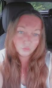 Happy 51st Birthday and Sunburn Relief