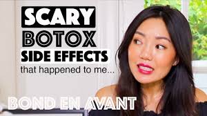 How long can the effects of botox when administered around the jaw last? I Almost Ruined My Face Botox Masseter Youtube