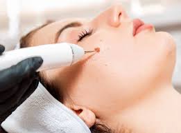 Pros And Cons Of Mole Removal In Dubai & Abu Dhabi