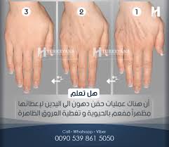 هل سمعتم عن حقن الدهون في اليدين Call Whatsapp Viber 00905398615050 تركيانا زراعة الشعر في ت Plastic Surgery Beauty Surgery