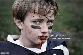 1.603 Traumatismo Craniano Fechado Stock Photos, High-Res Pictures, and  Images