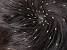 What Does Lice Look Like In Blonde Hair