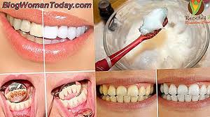 Como Blanquear Los Dientes Con Bicarbonato De Sodio Y Limon Salud