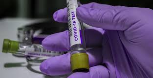 The two main branches detect either the presence of the virus or of antibodies produced in response. Testing For Coronavirus Healthwatch Cambridgeshire