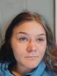 Seizure Aftermath and Safety Concerns