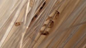Maybe you would like to learn more about one of these? Video Secrets Of Head Lice And How To Beat Them Shots Health News Npr