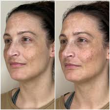 Savannah, MSN, NP-BC