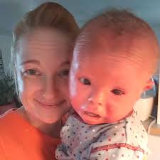 There is no cure, but a daily. Mum Bathes Baby In Bleach Twice A Week To Fight Off Infection Caused By Rare Skin Disease Irish Mirror Online