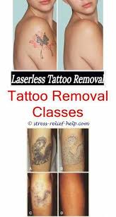Tattoo Removal Surgery Before And After Can You Remove A Tattoo In One Session Best Tattoo Removal Crea Laser Tattoo Tattoo Removal Cost Tattoo Removal Results