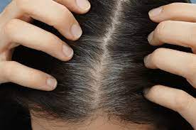 Every year, many children are born and each of them is unique. I Noticed My Toddler Has One Gray Hair What Should I Do