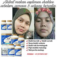 Majalah pa&ma 13.057 views1 year ago. Set Berpantang Terbaik Dan Murah Pengedar Shaklee Malaysia