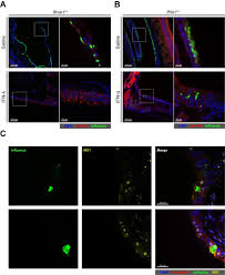 Andreas schwaderlapp bor i trelastveien 12 a, oppegård. Ifn L Prevents Influenza Virus Spread From The Upper Airways To The Lungs And Limits Virus Transmission Abstract Europe Pmc